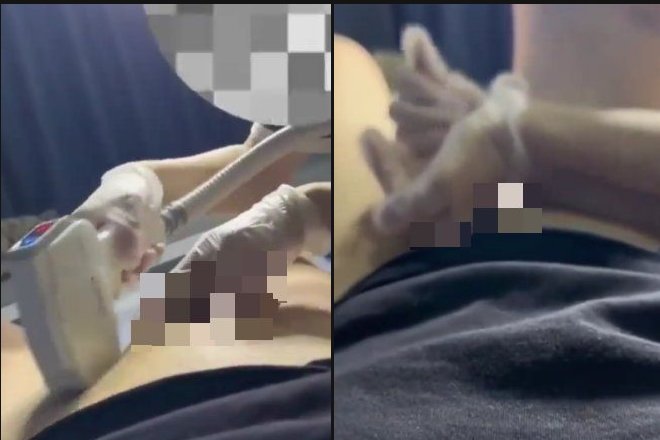 本物の手コキ動画 / メンズVIO脱毛中の射精客「あっ..」まさかの女性店員の優しすぎる対応が話題に